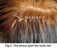 240723144101_Hair-Dying with henna-s.jpg